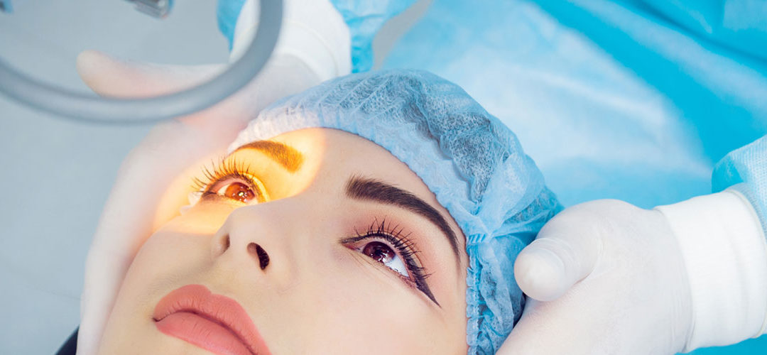 Laser Cataract Surgery